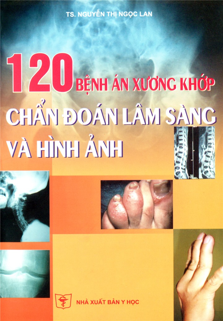 120 Bệnh án cơ xương khớp